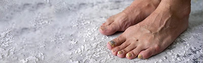 Are Fungal Infections Common