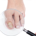 What is The Most Effective Treatment for Toenail Fungus?
